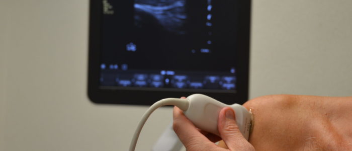 Echografie Eindhoven